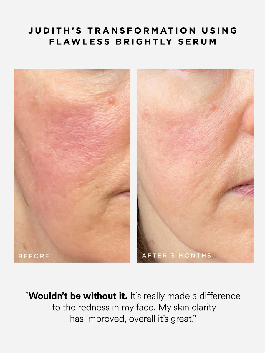 Flawless Brightly 10% Azelaic Acid Serum - Image 3