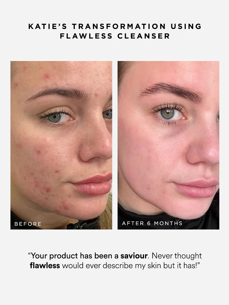 Flawless Cleanser - Image 3