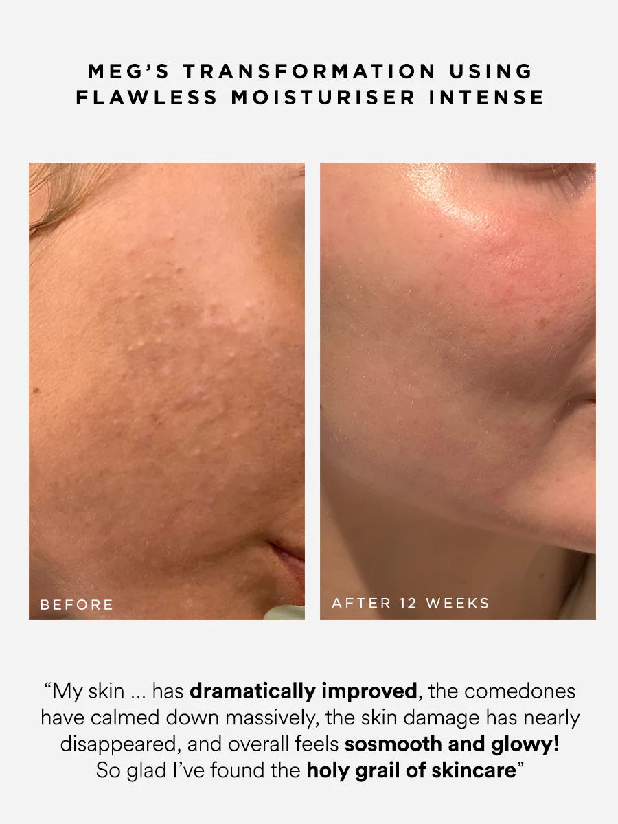 Flawless Moisturiser Intense - Image 4