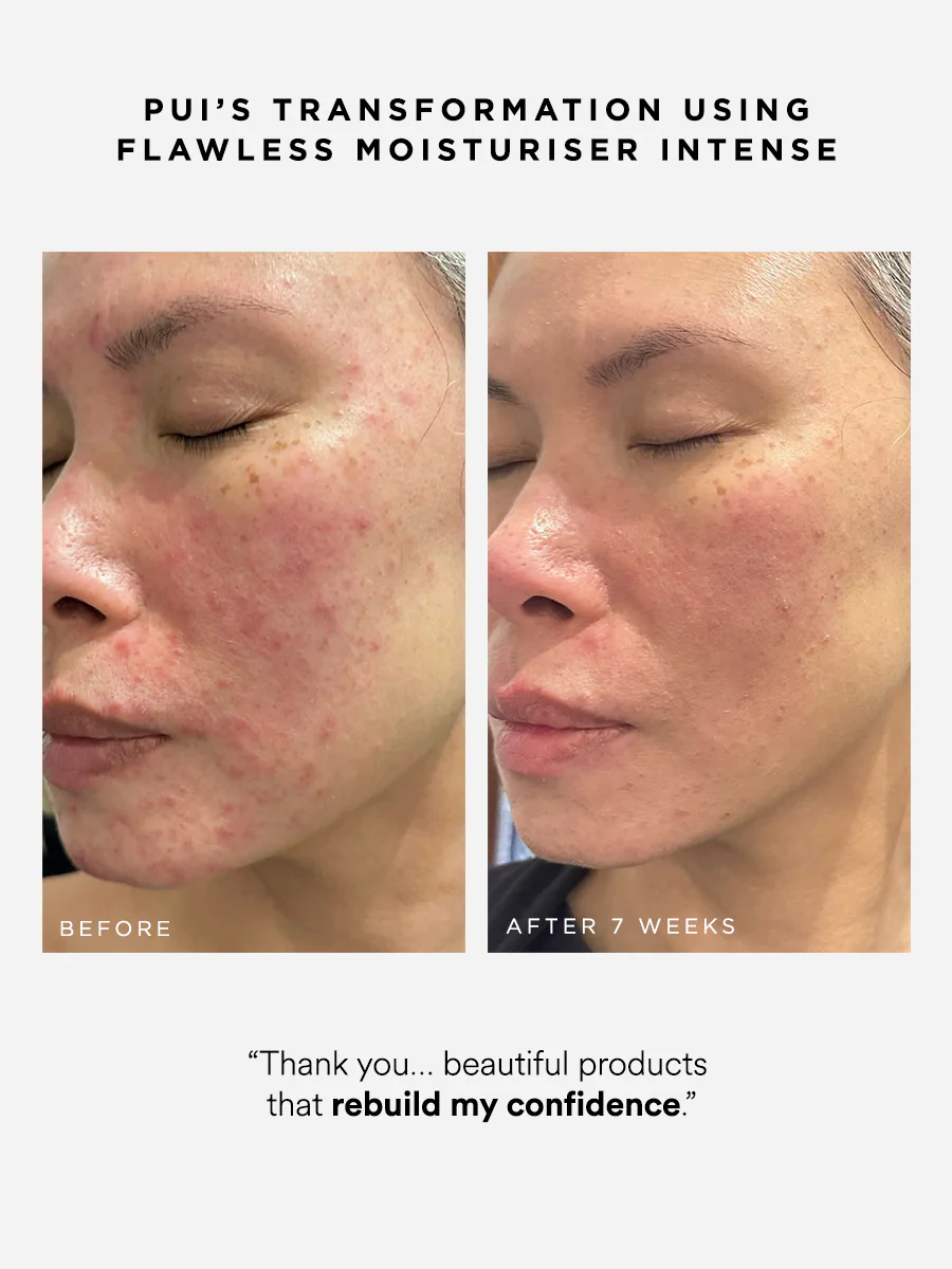 Flawless Moisturiser Intense - Image 5