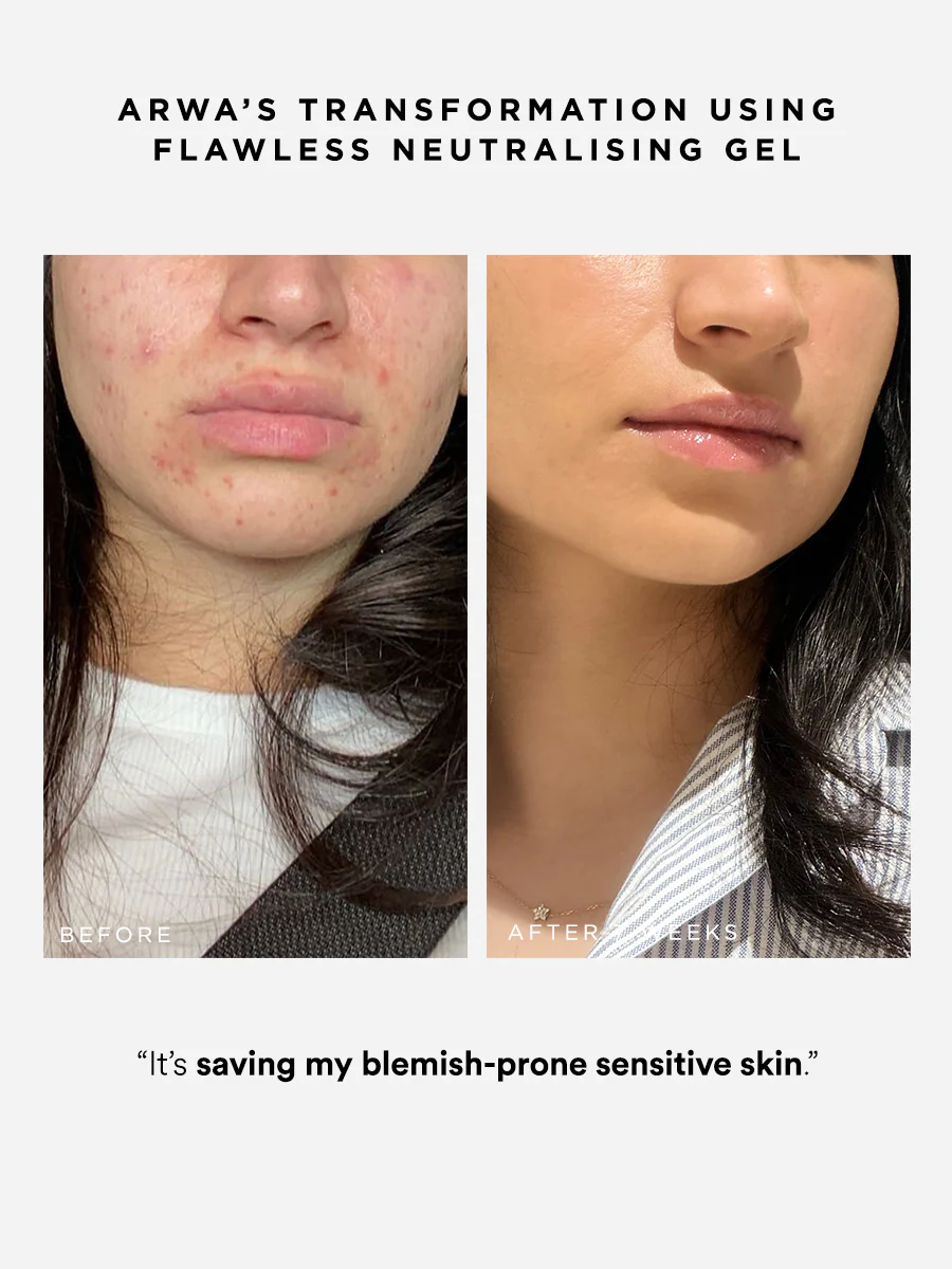 Flawless Neutralising Gel - Image 4