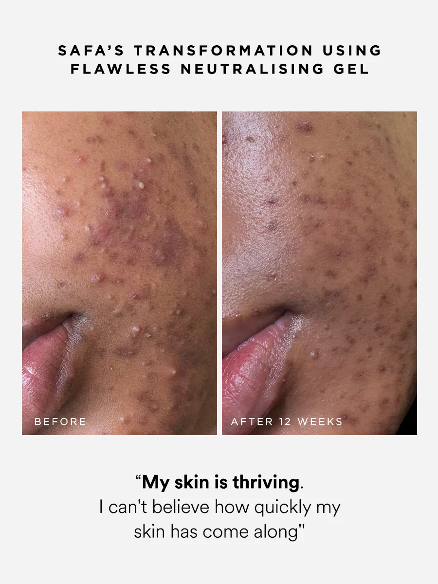 Flawless Neutralising Gel Roller - Image 3