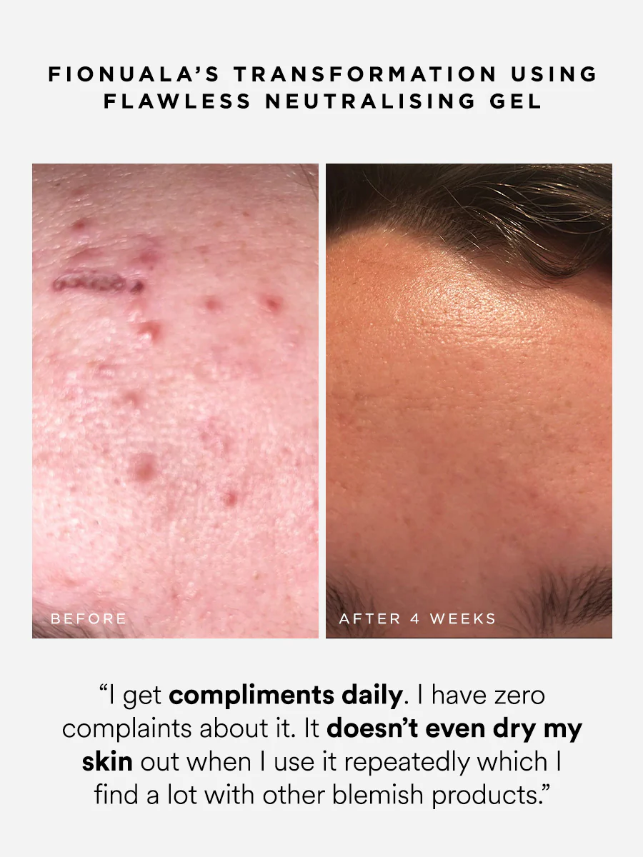 Flawless Neutralising Gel Roller - Image 4