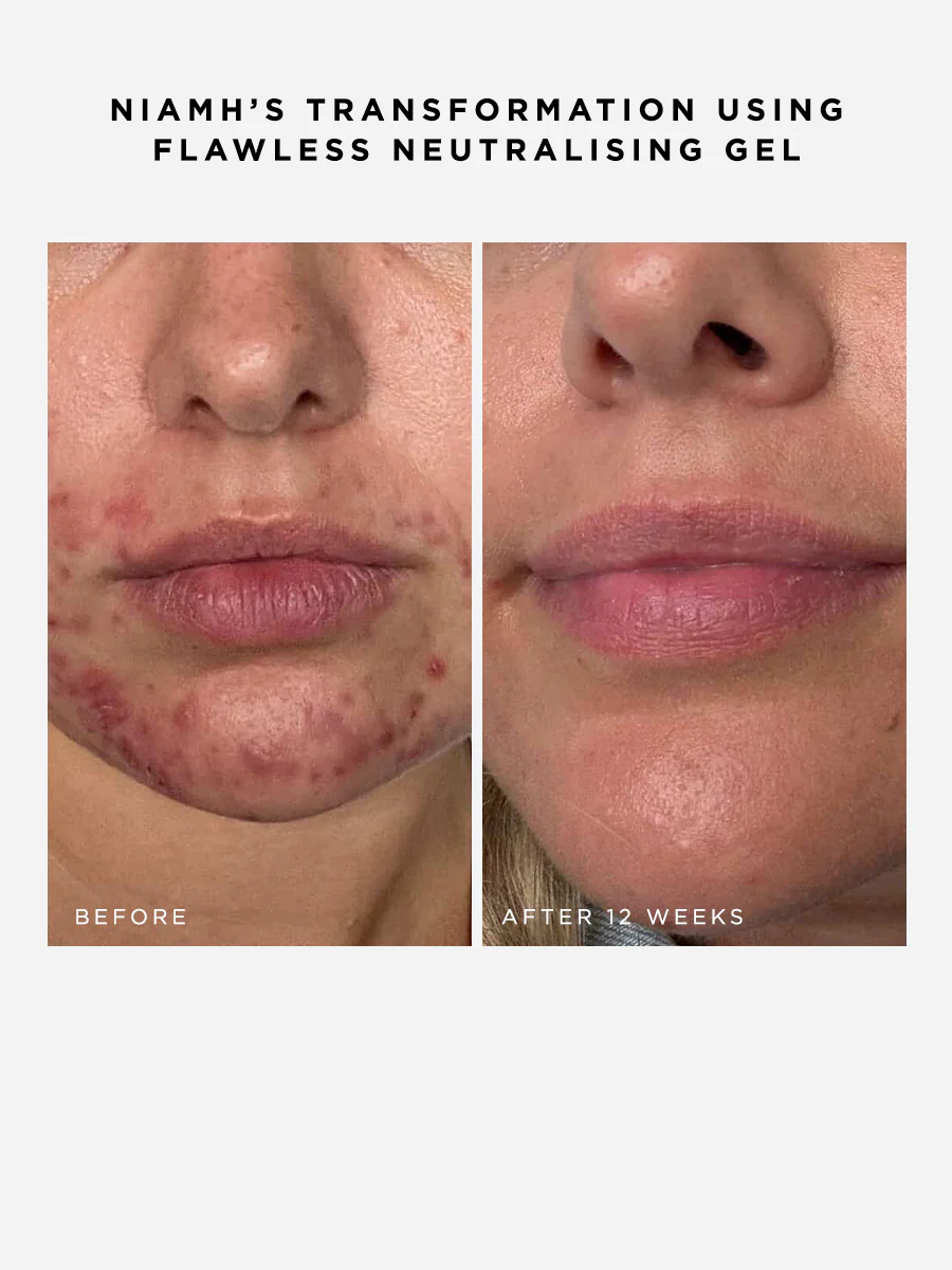 Flawless Neutralising Gel Roller - Image 5