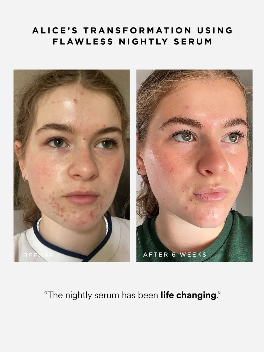 Flawless Nightly 2% Retinoid Serum - Image 3