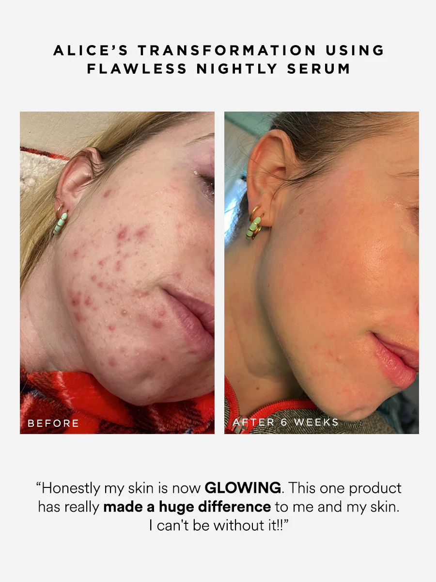 Flawless Nightly 2% Retinoid Serum - Image 4