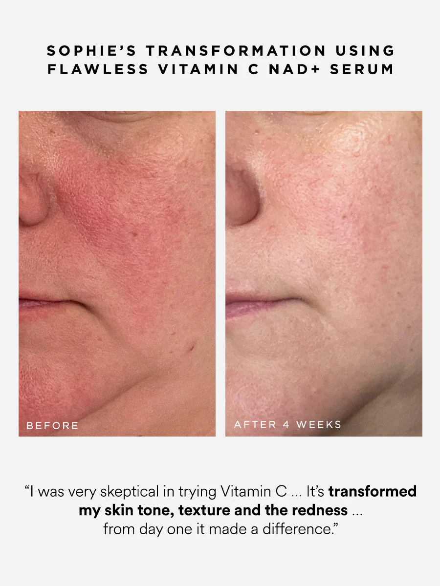 Flawless Vitamin C NAD+ Serum - Image 3