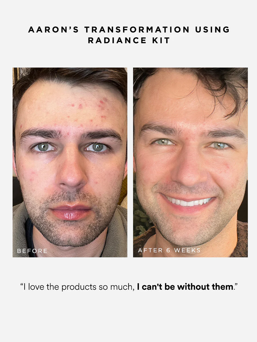 Radiance Kit - Image 3