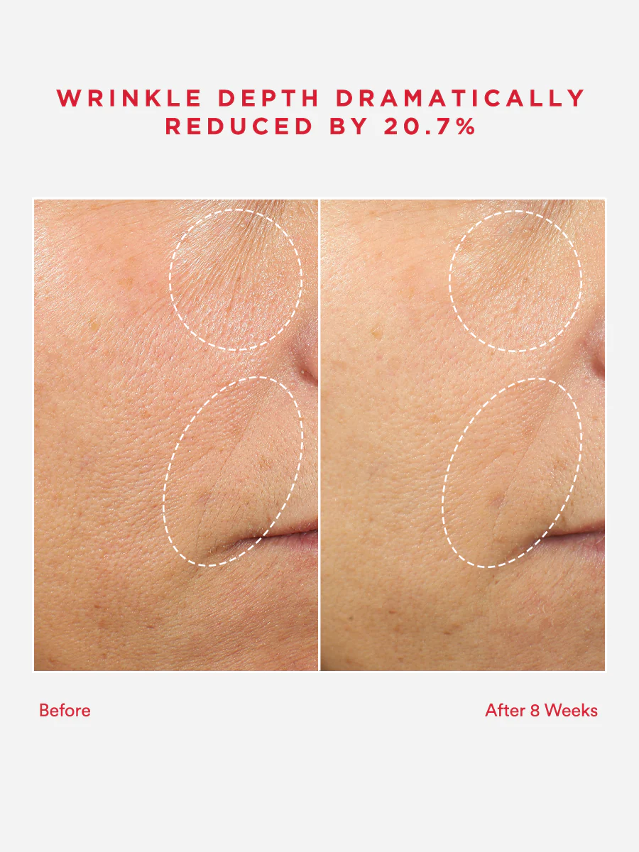 The 8 Years Younger Set - Image 3