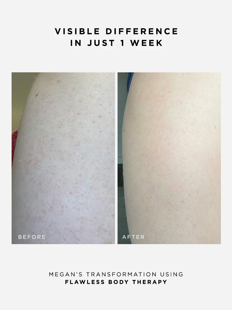 The Body Confidence Set - Image 3