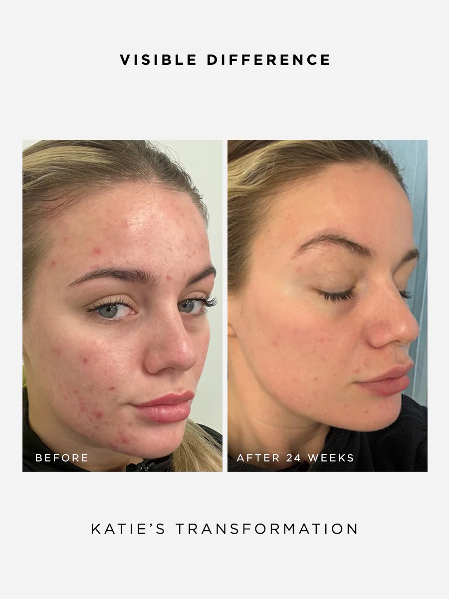 The Clarity Full Size Set - Image 3