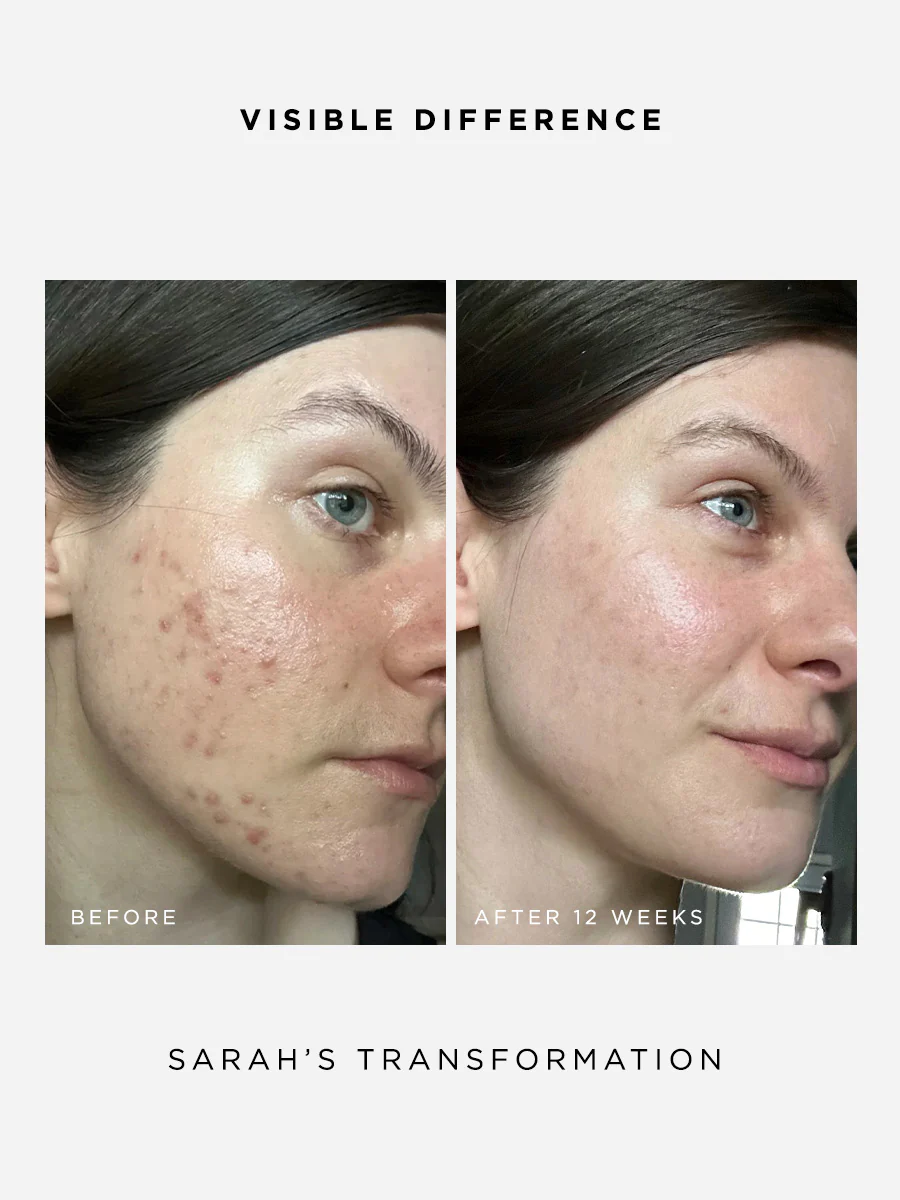 The Clarity Full Size Set - Image 4