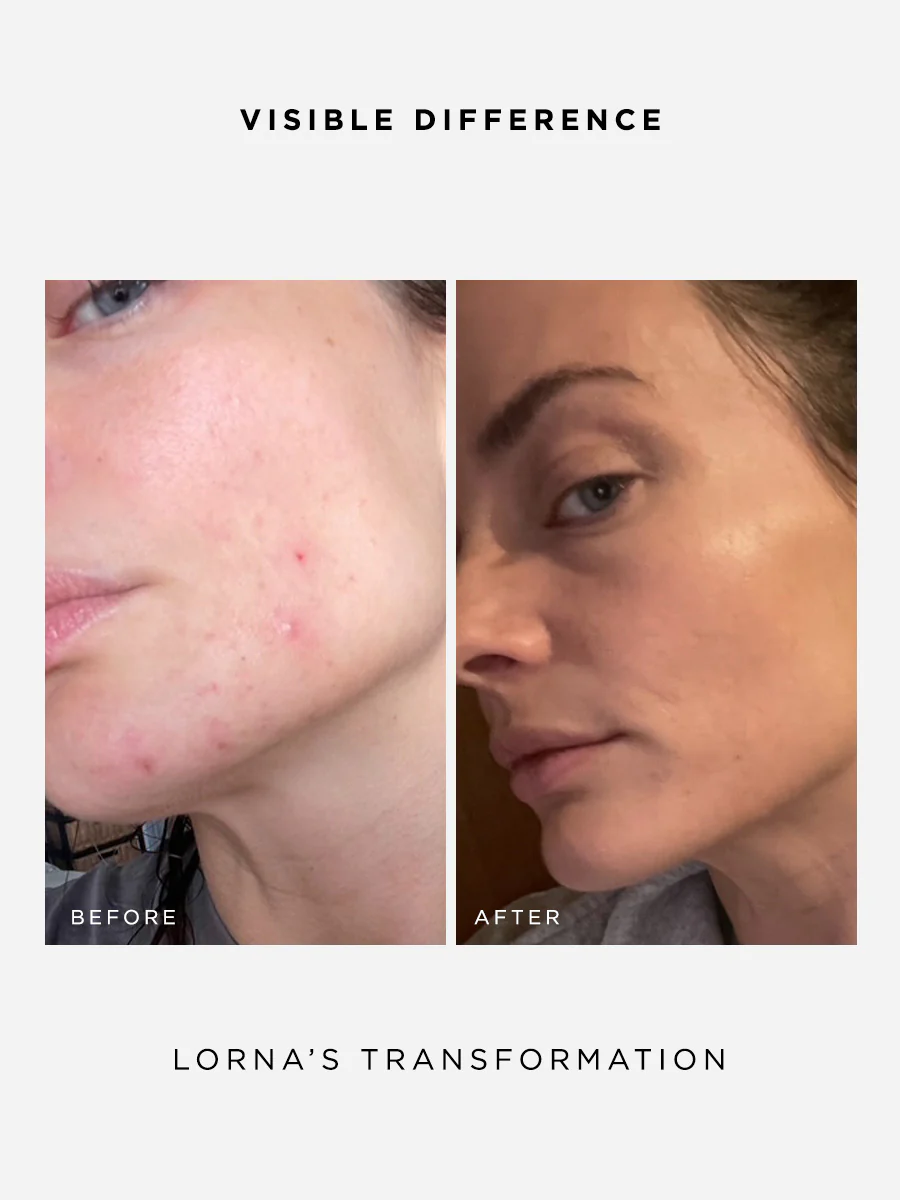 The Clarity Full Size Set - Image 5