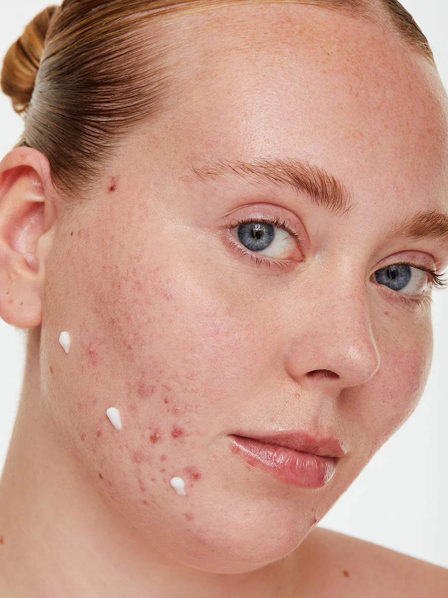 The Clarity Pro Duo - Image 4