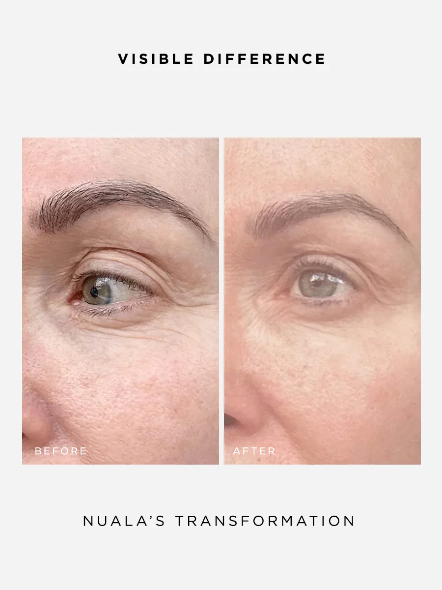 The Radiance Full Size Set - Image 3