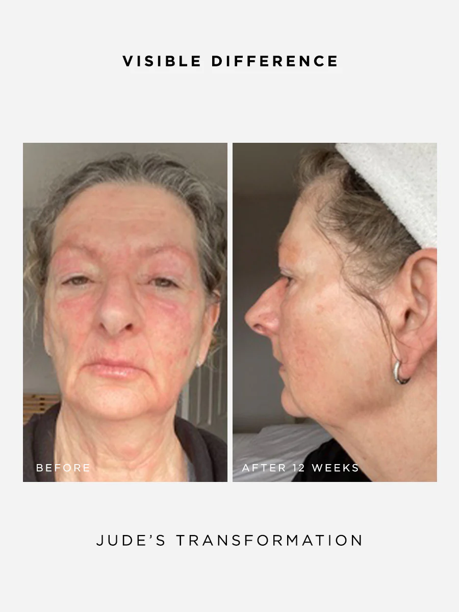 The Radiance Full Size Set - Image 4