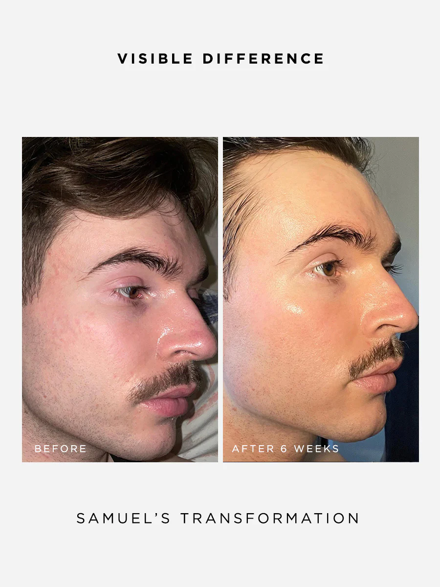 The Radiance Full Size Set - Image 5