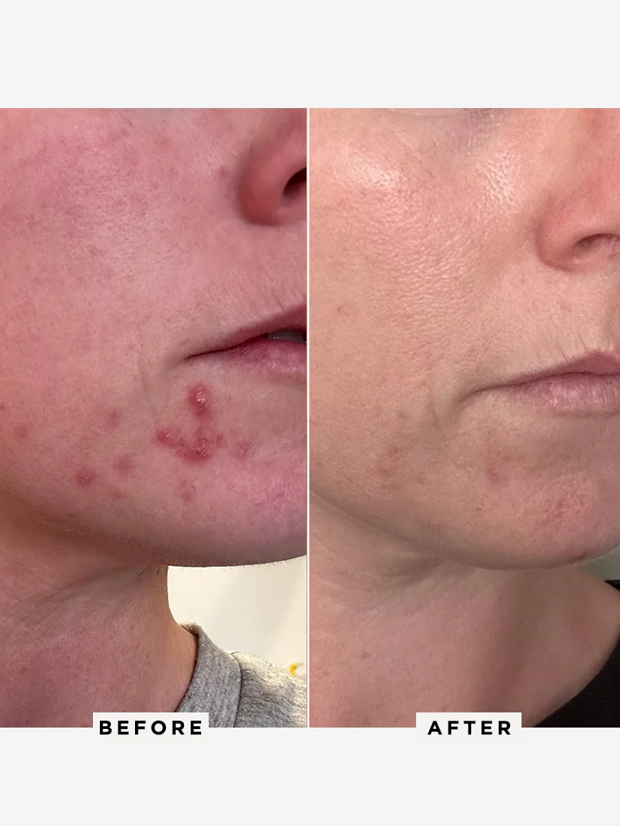 The Radiance Pro Duo - Image 4